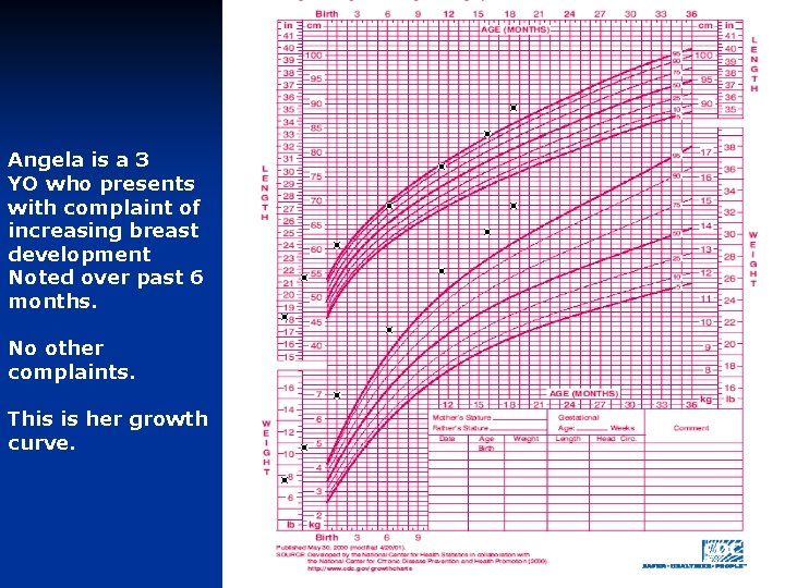 Angela is a 3 YO who presents with complaint of increasing breast development Noted