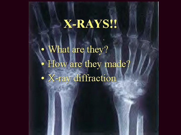 X-RAYS!! • What are they? • How are they made? • X-ray diffraction 