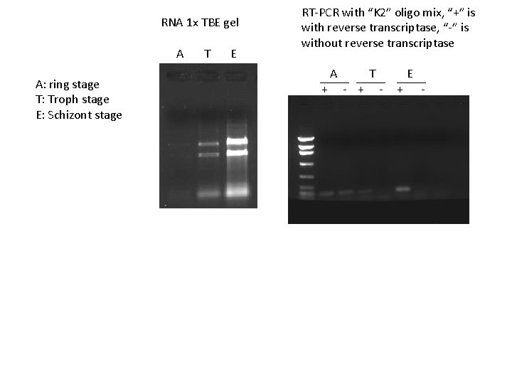 RNA 1 x TBE gel A A: ring stage T: Troph stage E: Schizont