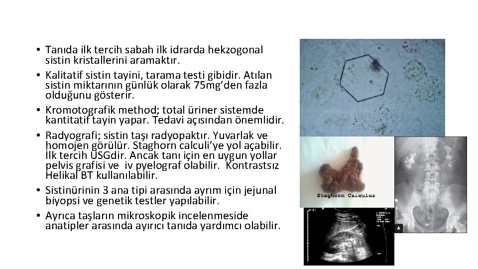  • Tanıda ilk tercih sabah ilk idrarda hekzogonal sistin kristallerini aramaktır. • Kalitatif