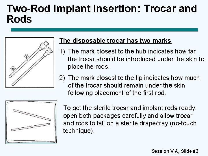 Two-Rod Implant Insertion: Trocar and Rods The disposable trocar has two marks 1) The