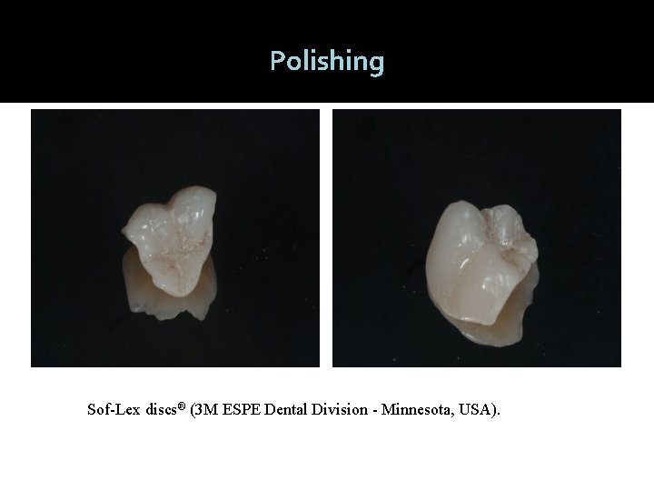 Polishing Sof-Lex discs® (3 M ESPE Dental Division - Minnesota, USA). 