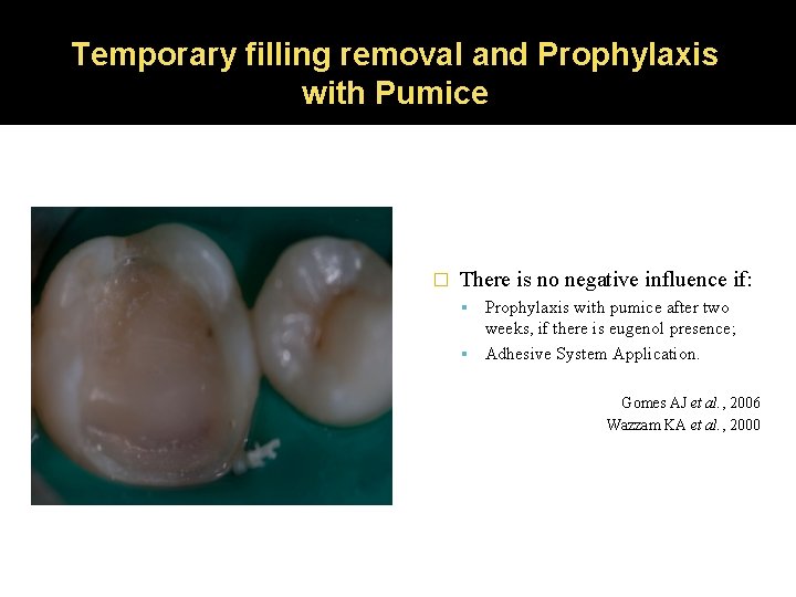 Temporary filling removal and Prophylaxis with Pumice � There is no negative influence if: