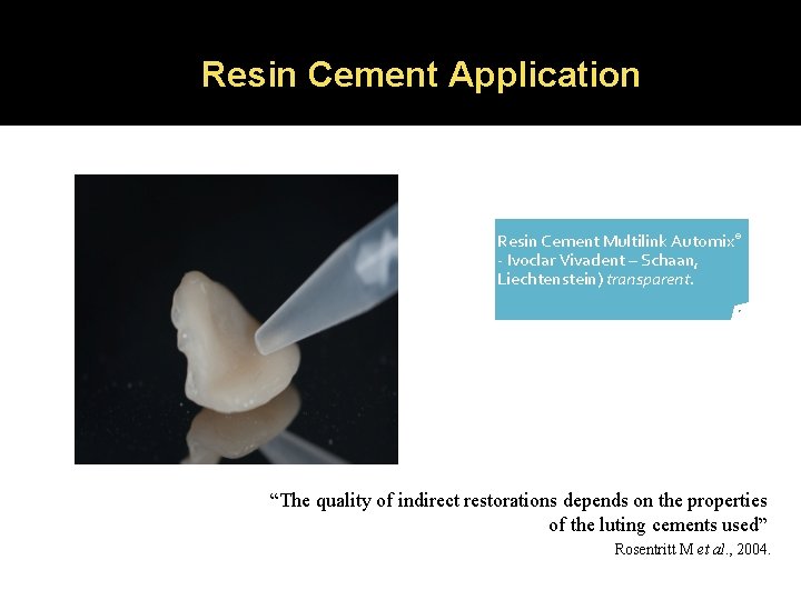 Resin Cement Application Resin Cement Multilink Automix® ‐ Ivoclar Vivadent – Schaan, Liechtenstein) transparent.
