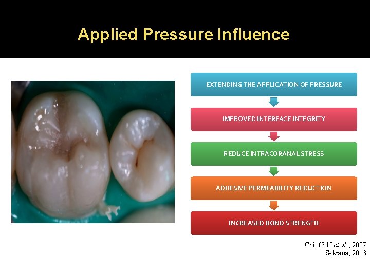 Applied Pressure Influence EXTENDING THE APPLICATION OF PRESSURE IMPROVED INTERFACE INTEGRITY REDUCE INTRACORANAL STRESS