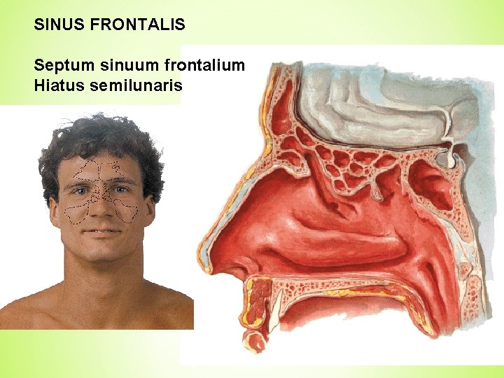 SINUS FRONTALIS Septum sinuum frontalium Hiatus semilunaris 