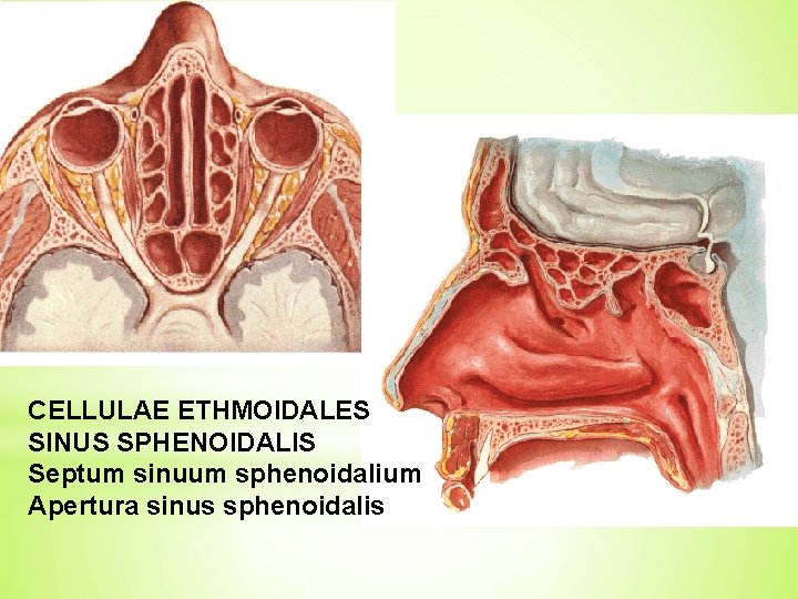 CELLULAE ETHMOIDALES SINUS SPHENOIDALIS Septum sinuum sphenoidalium Apertura sinus sphenoidalis 