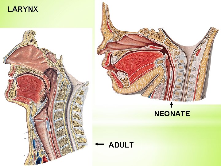 LARYNX NEONATE ADULT 