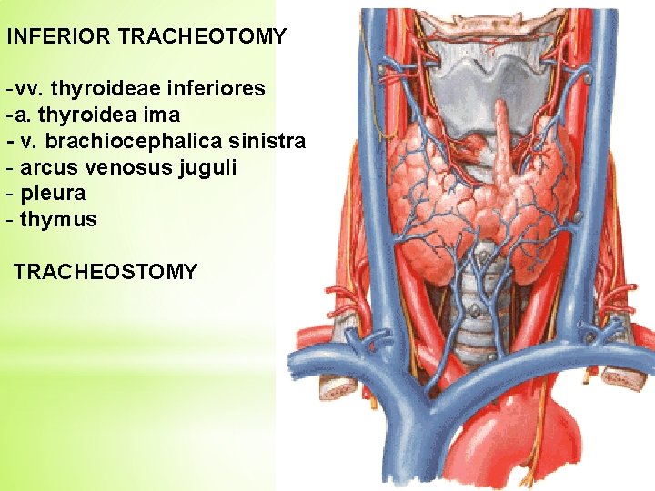 INFERIOR TRACHEOTOMY -vv. thyroideae inferiores -a. thyroidea ima - v. brachiocephalica sinistra - arcus