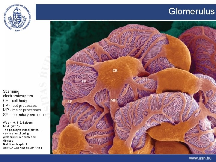 Glomerulus Scanning electromicrogram CB - cell body FP - foot processes MP - major