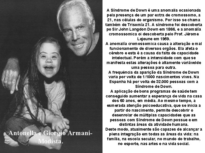 Antonella e Giorgio Armani. Modista. A Síndrome de Down é uma anomalia ocasionada pela