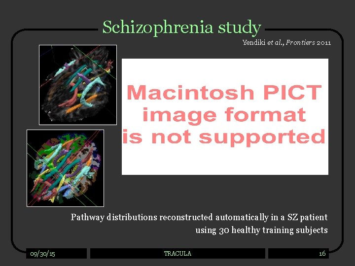 Schizophrenia study Yendiki et al. , Frontiers 2011 Pathway distributions reconstructed automatically in a