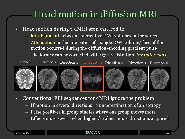 Head motion in diffusion MRI • Head motion during a d. MRI scan lead