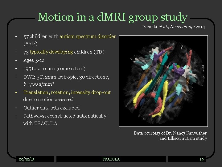 Motion in a d. MRI group study Yendiki et al. , Neuroimage 2014 •