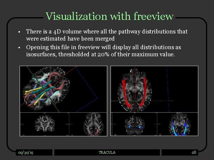 Visualization with freeview • There is a 4 D volume where all the pathway