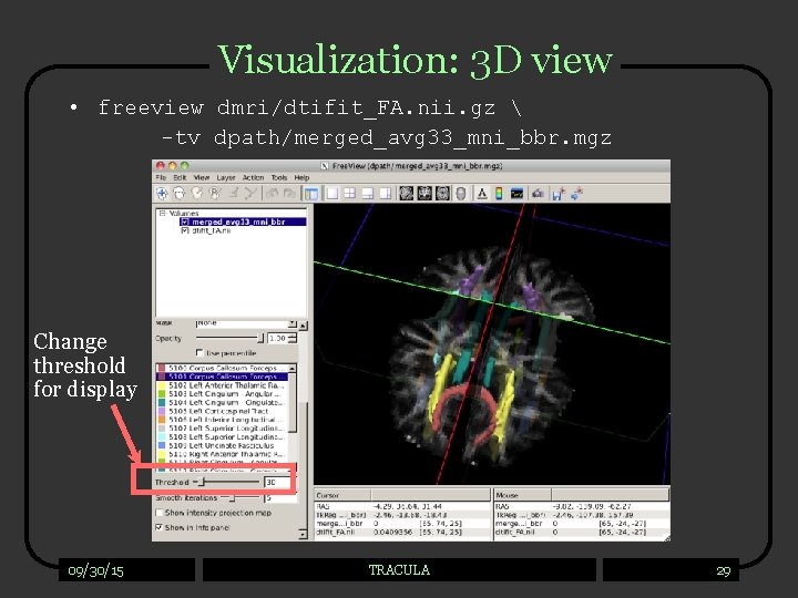 Visualization: 3 D view • freeview dmri/dtifit_FA. nii. gz  -tv dpath/merged_avg 33_mni_bbr. mgz