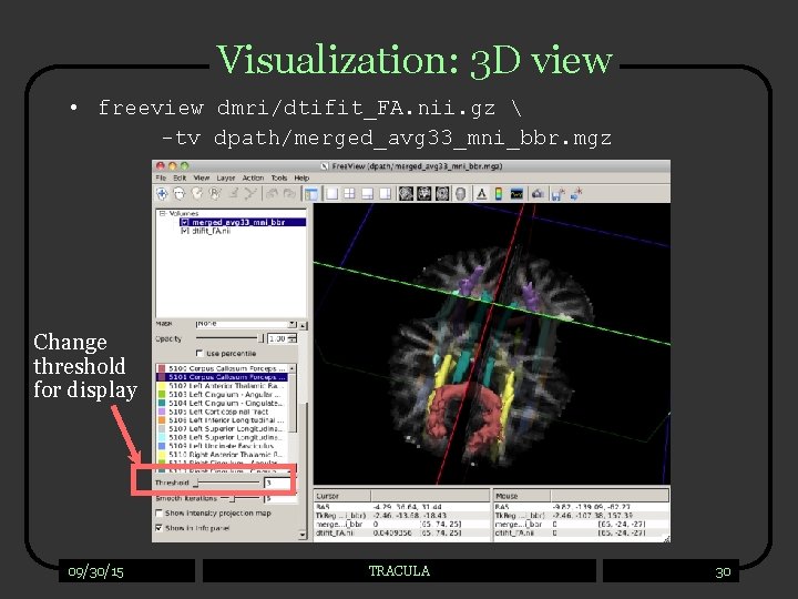 Visualization: 3 D view • freeview dmri/dtifit_FA. nii. gz  -tv dpath/merged_avg 33_mni_bbr. mgz