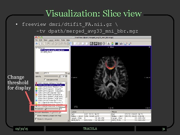 Visualization: Slice view • freeview dmri/dtifit_FA. nii. gz  -tv dpath/merged_avg 33_mni_bbr. mgz Change