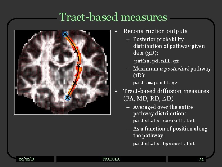 Tract-based measures • Reconstruction outputs – Posterior probability distribution of pathway given data (3