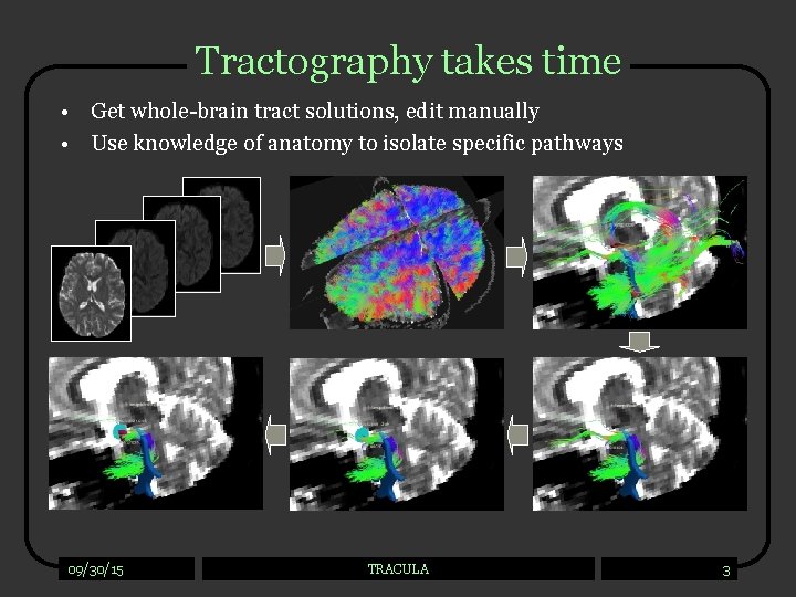 Tractography takes time • Get whole-brain tract solutions, edit manually • Use knowledge of