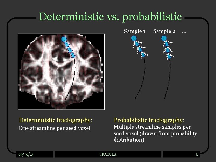 Deterministic vs. probabilistic Sample 1 Sample 2 … Deterministic tractography: Probabilistic tractography: One streamline