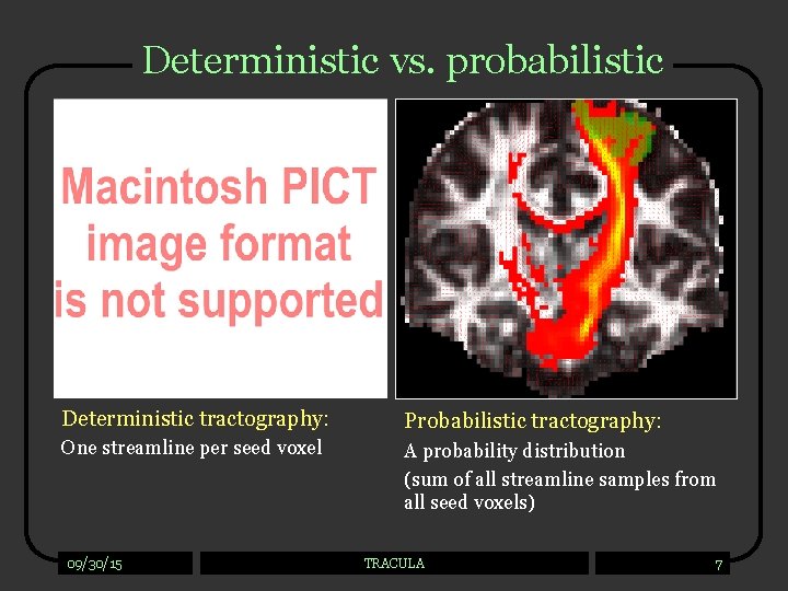 Deterministic vs. probabilistic Deterministic tractography: Probabilistic tractography: One streamline per seed voxel A probability