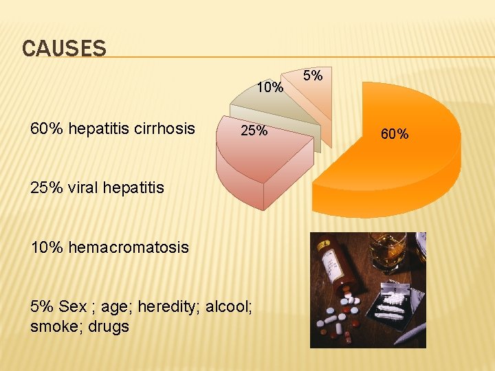 CAUSES 10% 60% hepatitis cirrhosis 25% viral hepatitis 10% hemacromatosis 5% Sex ; age;