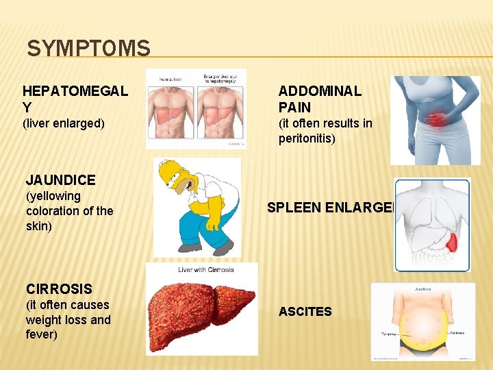 SYMPTOMS HEPATOMEGAL Y ADDOMINAL PAIN (liver enlarged) (it often results in peritonitis) JAUNDICE (yellowing