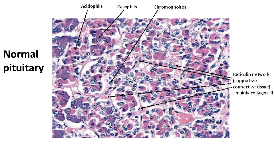 Acidophils Normal pituitary Basophils Chromophobes Reticulin network (supportive connective tissue). . mainly collagen III