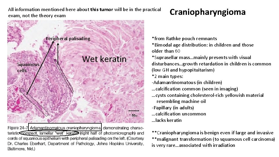 All information mentioned here about this tumor will be in the practical exam, not