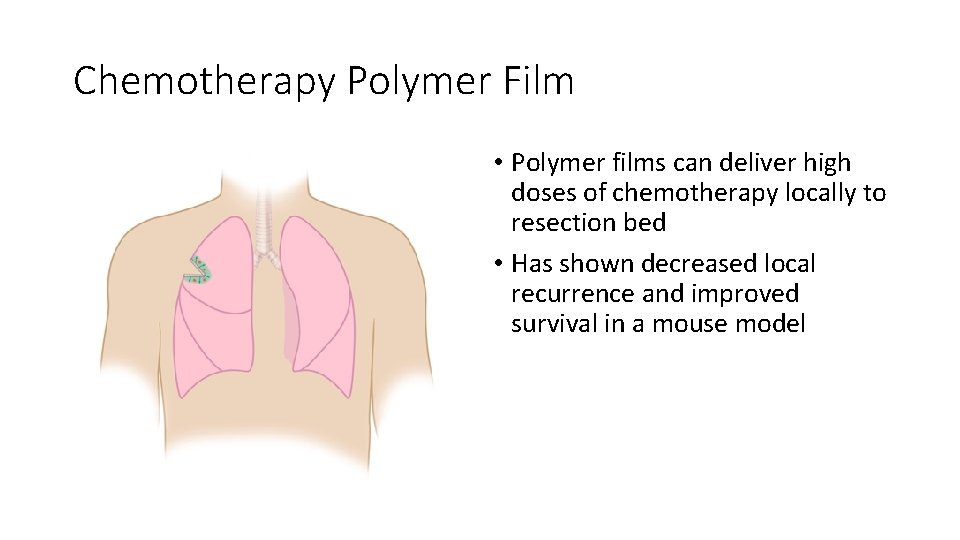 Chemotherapy Polymer Film • Polymer films can deliver high doses of chemotherapy locally to