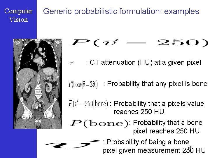 Computer Vision Generic probabilistic formulation: examples : CT attenuation (HU) at a given pixel