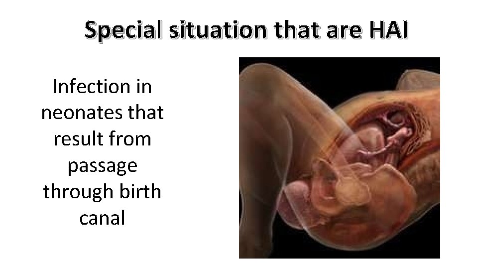 Special situation that are HAI Infection in neonates that result from passage through birth