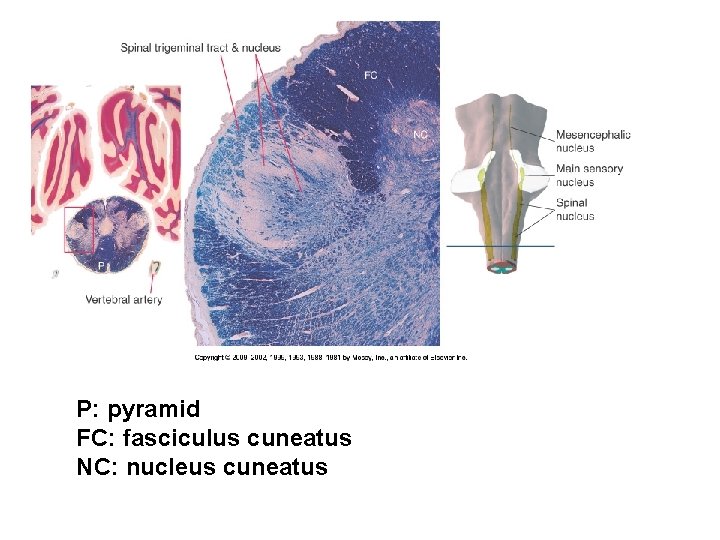 P: pyramid FC: fasciculus cuneatus NC: nucleus cuneatus 