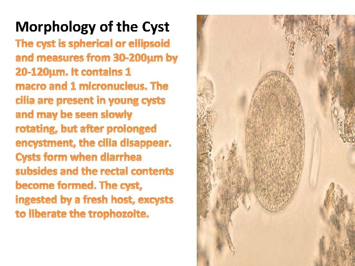 Morphology of the Cyst The cyst is spherical or ellipsoid and measures from 30