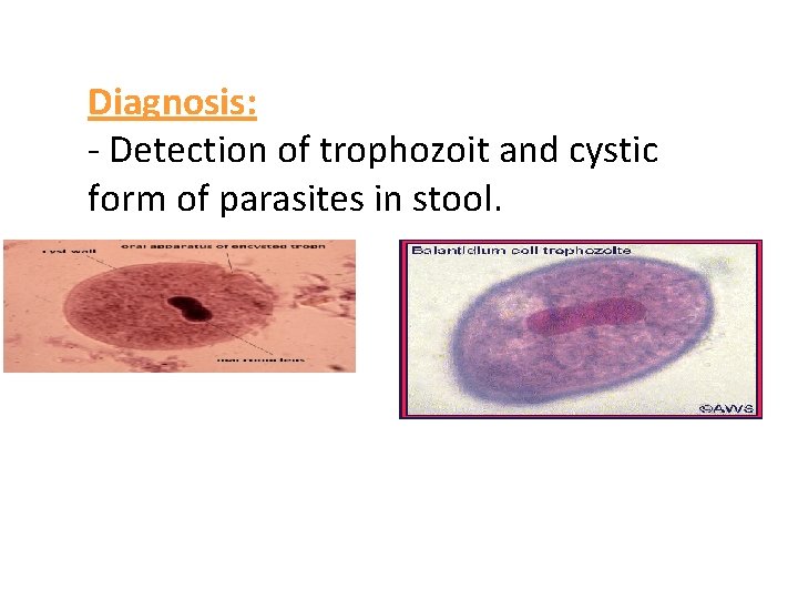 Diagnosis: - Detection of trophozoit and cystic form of parasites in stool. 
