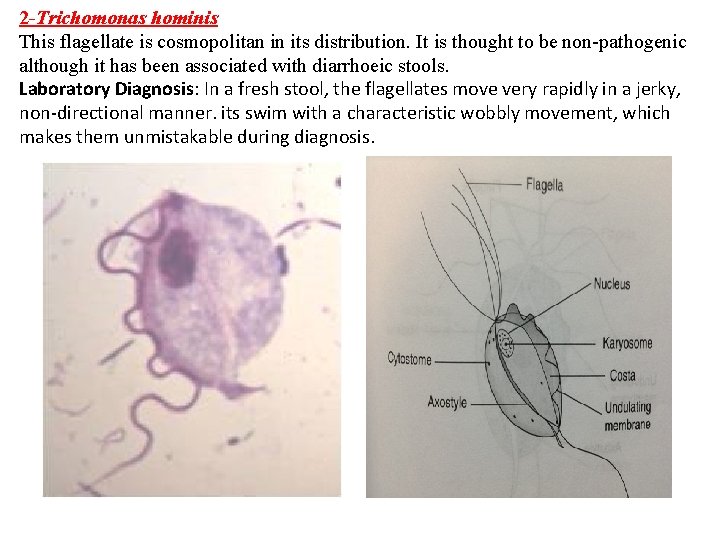 2 -Trichomonas hominis This flagellate is cosmopolitan in its distribution. It is thought to