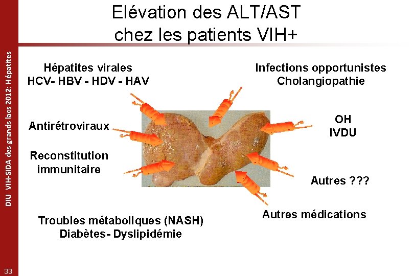 DIU VIH-SIDA des grands lacs 2012: Hépatites Elévation des ALT/AST chez les patients VIH+