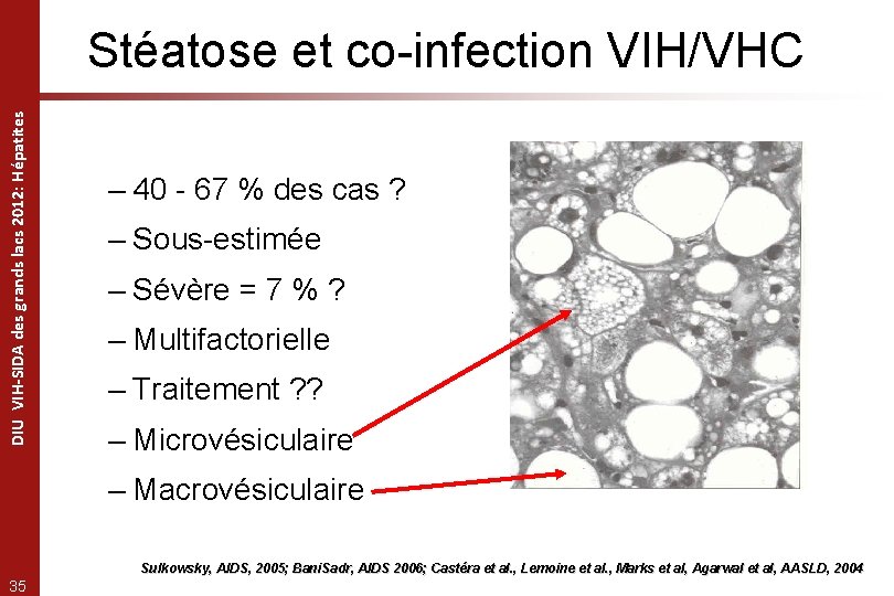 DIU VIH-SIDA des grands lacs 2012: Hépatites Stéatose et co-infection VIH/VHC – 40 -