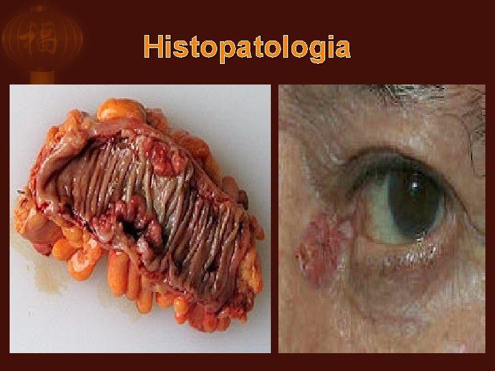 Histopatologia 