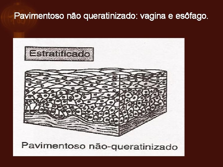 Pavimentoso não queratinizado: vagina e esôfago. 