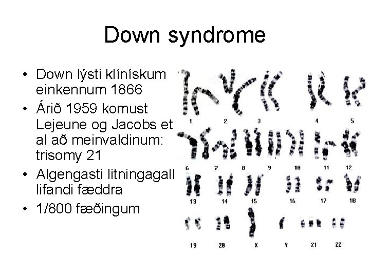 Down syndrome • Down lýsti klínískum einkennum 1866 • Árið 1959 komust Lejeune og