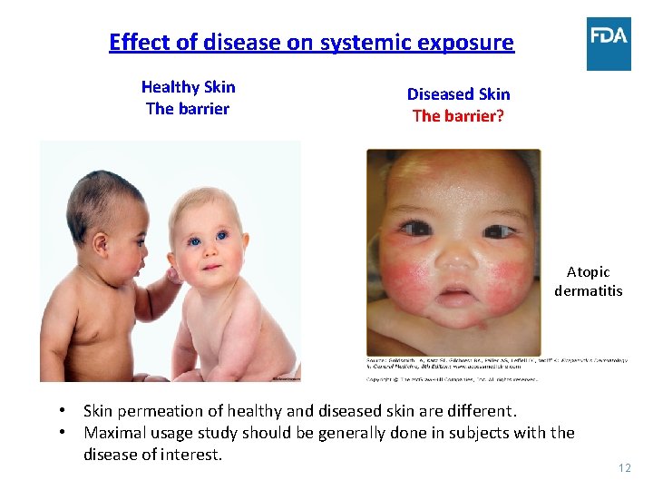 Effect of disease on systemic exposure Healthy Skin The barrier Diseased Skin The barrier?