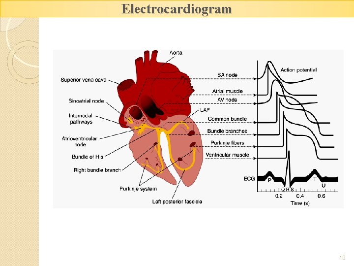Electrocardiogram 10 