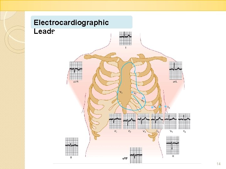 Electrocardiographic Leads a. VF 14 