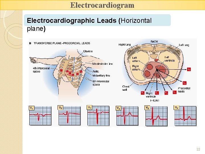 Electrocardiogram Electrocardiographic Leads (Horizontal plane) 22 