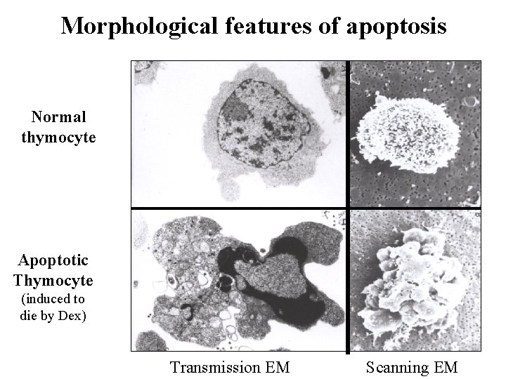 Morphological features of apoptosis Normal thymocyte Apoptotic Thymocyte (induced to die by Dex) Transmission