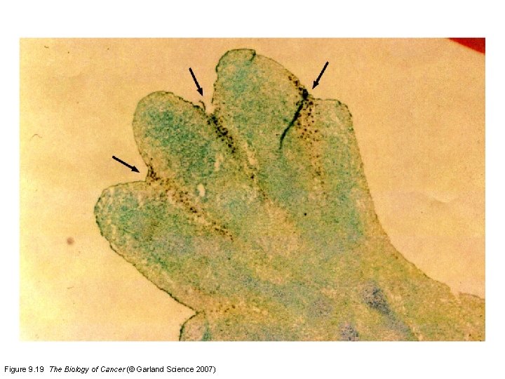 Figure 9. 19 The Biology of Cancer (© Garland Science 2007) 