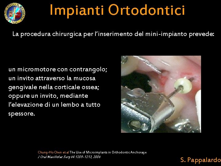 Impianti Ortodontici La procedura chirurgica per l’inserimento del mini-impianto prevede: un micromotore contrangolo; un