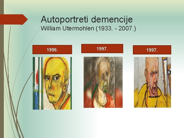 Autoportreti demencije William Utermohlen (1933. - 2007. ) 1996. 1997. 